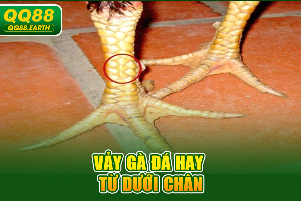 Vảy gà đá hay từ dưới chân
